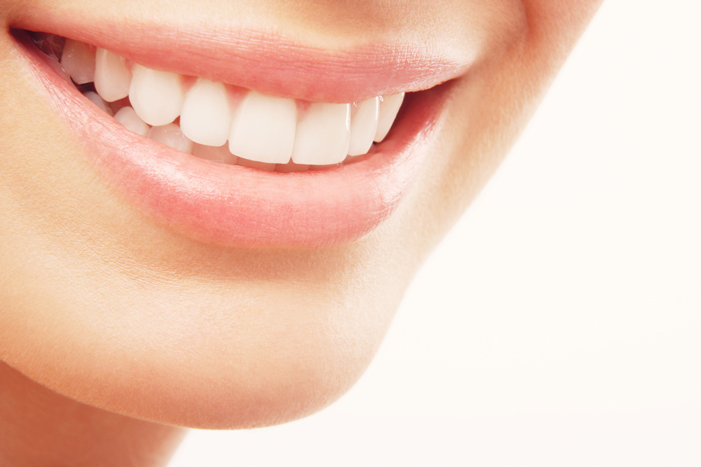 Diastema Tedavisi